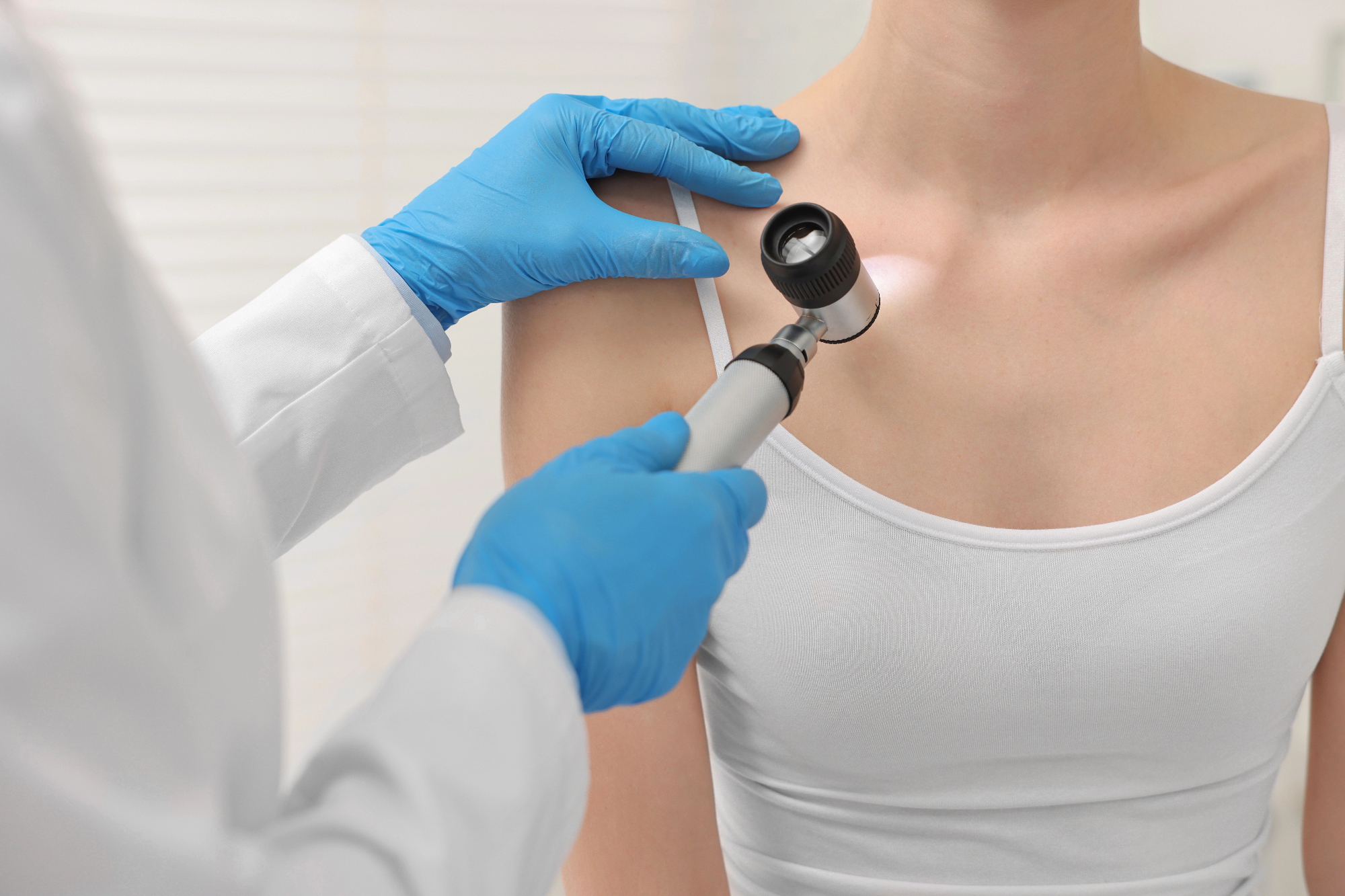 Dermatologija ni samo zdravljenje bolezni ampak tudi podpora pri vsakdanjih težavah s kožo